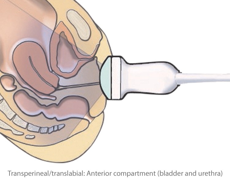 Transperineal/translabial: Anterior compartment (bladder and urethra)